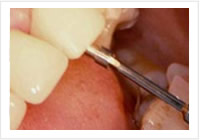 Periodontia